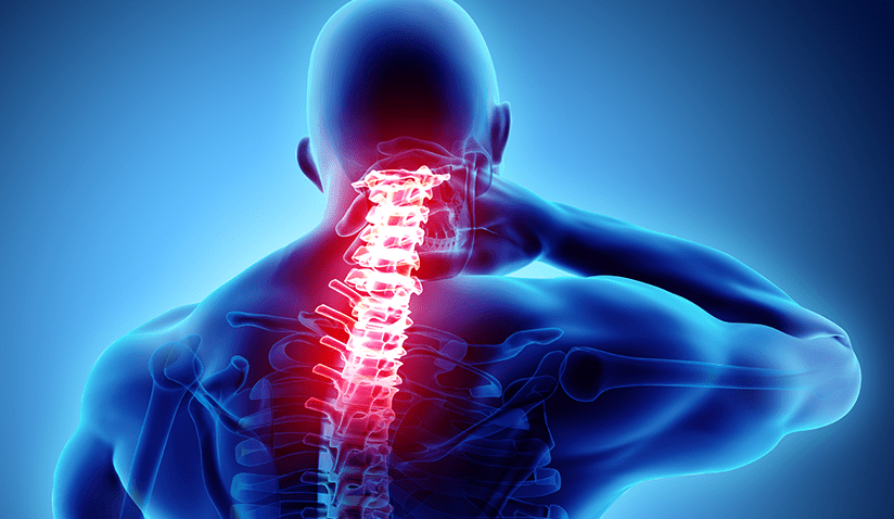 You are currently viewing CERVICAL SPONDYLOSIS